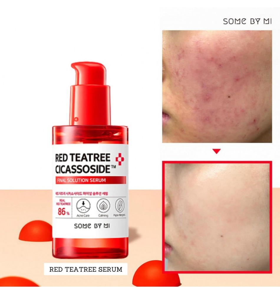 [SOMEBYMI] Red Teatree Cicassoside Final Solution Serum - 50ml