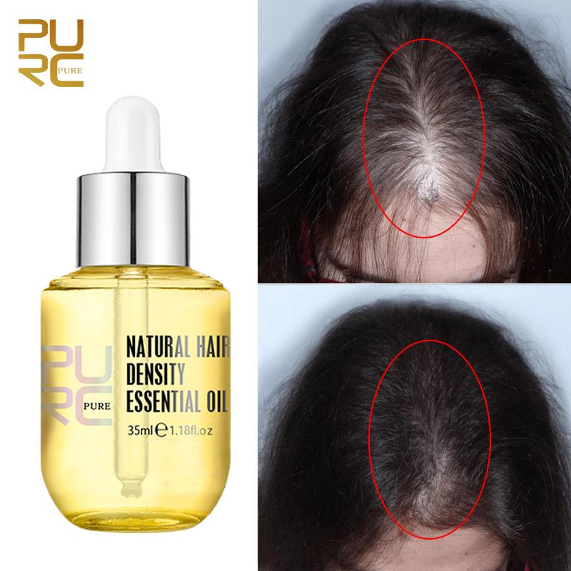 Ginger Hair Growth Products Prevent Hair Loss Essential Oil Fast Growing Scalp Thickening Treatment Health Men Women Hair Care